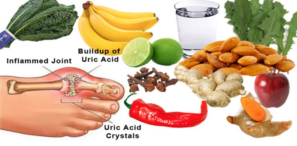 Uric Acid Level Chart